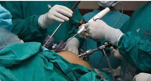 什么是减重手术?