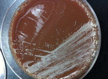 什么是咽拭子培养?