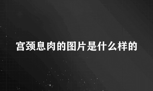 宫颈息肉的图片是什么样的