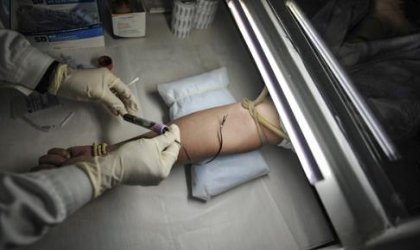 如何快速判断一个女的是否患有艾滋病