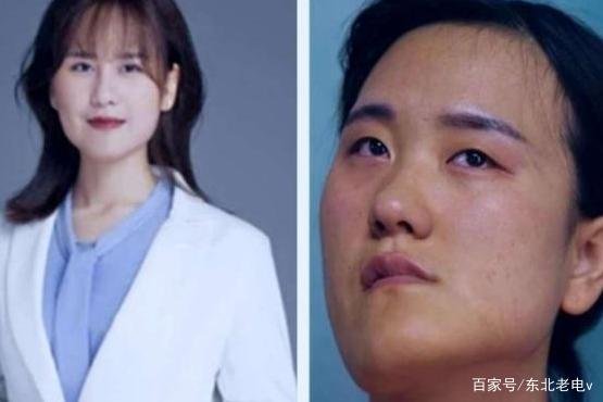 歪脸女孩整容成功后,从丑小鸭变白天鹅,为何还要回山村当老师?