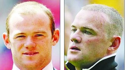 寻找鲁尼最新照片,鲁尼植发前后对比图片