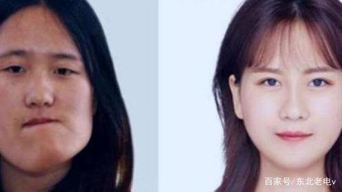 歪脸女孩整容成功后,从丑小鸭变白天鹅,为何还要回山村当老师?