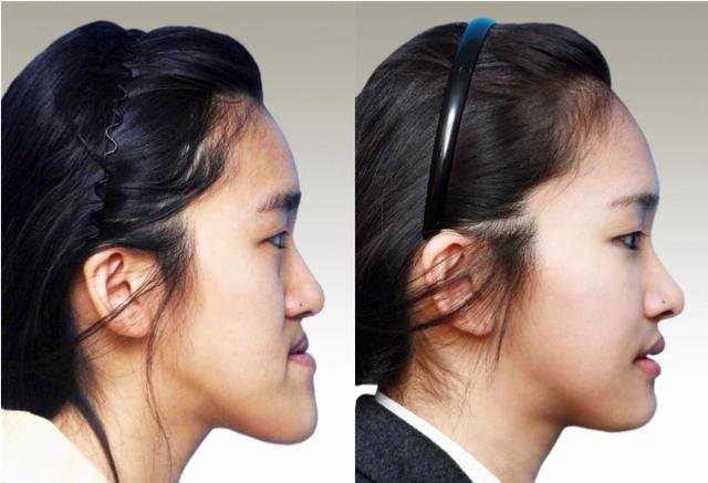 整牙有年龄限制吗?