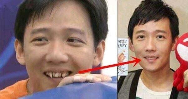 整牙有年龄限制吗?