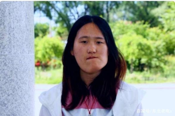 歪脸女孩整容成功后,从丑小鸭变白天鹅,为何还要回山村当老师?