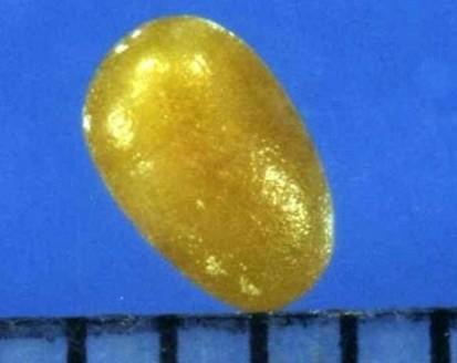 舍利子究竟是什么？