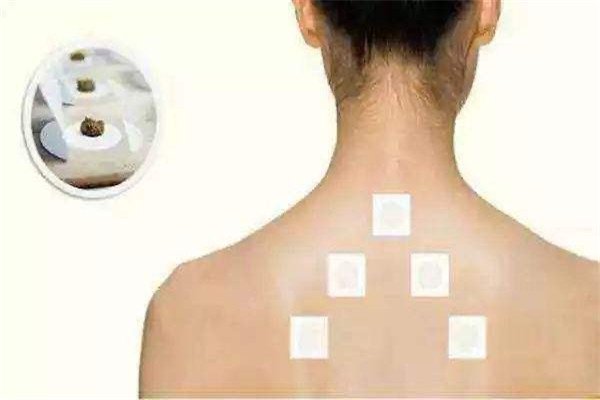 三伏贴的配方是什么？