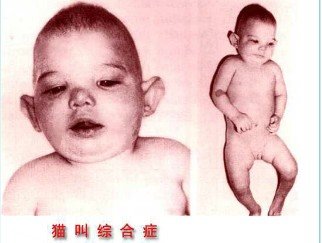 警惕小孩学“猫叫”！
