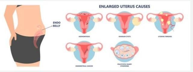 自然流产后注意事项和怎样调理