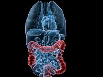 结肠癌是什么原因引起的?