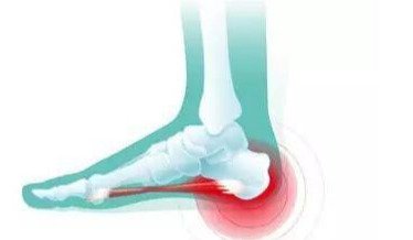 脚底板疼痛是怎么回事?