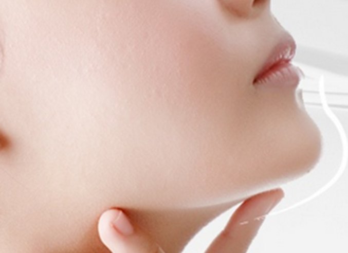 自体脂肪丰下巴的缺点是什么